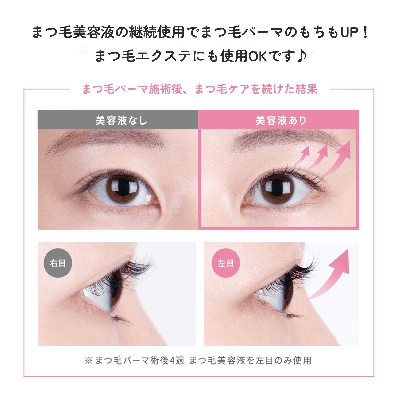 まつ毛美容液の継続使用でまつ毛パーマのもちもUP！まつ毛エクステにも使用OKです♪まつ毛パーマ施術後、まつ毛ケアを続けた結果イメージ